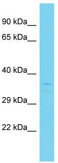 Host: Rabbit; Target Name: C4orf27; Sample Tissue: 721_B Whole Cell lysates; Antibody Dilution: 1.0ug/mlC4orf27 is supported by BioGPS gene expression data to be expressed in 721_B