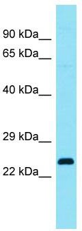 Host: Rabbit; Target Name: C4orf45; Sample Tissue: Fetal Lung lysates; Antibody Dilution: 1.0 ug/ml