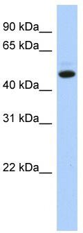 WB Suggested Anti-C5orf36 Antibody Titration: 0.2-1 ug/ml; ELISA Titer: 1:1562500; Positive Control: Hela cell lysate