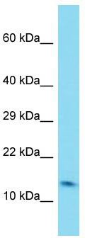 Host: Rabbit; Target Name: C6orf1; Sample Tissue: Fetal Lung lysates; Antibody Dilution: 1.0 ug/ml