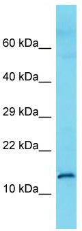 Host: Rabbit; Target Name: C9orf57; Sample Tissue: Fetal Kidney lysates; Antibody Dilution: 1.0 ug/ml.