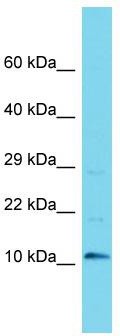 Host: Rabbit; Target Name: C9orf170; Sample Tissue: MCF7 Whole Cell lysates; Antibody Dilution: 1.0 ug/ml