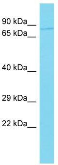 Host: Rabbit; Target Name: C10orf90; Sample Tissue: 721_B Whole Cell lysates; Antibody Dilution: 1.0ug/ml