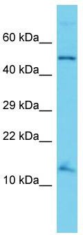 Host: Rabbit; Target Name: ANAPC15; Sample Tissue: HT1080 Whole Cell lysates; Antibody Dilution: 1.0ug/ml