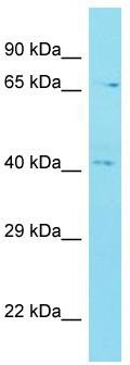 Host: Rabbit; Target Name: C12orf56; Sample Tissue: MDA-MB-435S Whole Cell lysates; Antibody Dilution: 1.0ug/ml