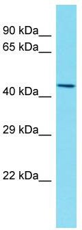 Host: Rabbit; Target Name: C12orf56; Sample Tissue: Fetal Lung lysates; Antibody Dilution: 1.0ug/ml