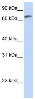 WB Suggested Anti-C14orf37 Antibody Titration: 0.2-1 ug/ml; ELISA Titer: 1: 62500; Positive Control: Human Lung