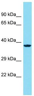 Host: Rabbit; Target Name: C14orf79; Sample Tissue: HepG2 Whole Cell lysates; Antibody Dilution: 1.0 ug/ml.