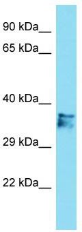 Host: Rabbit; Target Name: C14orf79; Sample Tissue: Jurkat Whole Cell lysates; Antibody Dilution: 1.0 ug/ml.