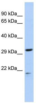 WB Suggested Anti-C14orf80 Antibody Titration: 0.2-1 ug/ml; ELISA Titer: 1:1562500; Positive Control: Jurkat cell lysate