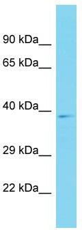 Host: Rabbit; Target Name: C14orf105; Sample Tissue: THP-1 Whole Cell lysates; Antibody Dilution: 1.0ug/ml