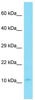 Host: Rabbit; Target Name: C14orf142; Sample Tissue: Jurkat Whole Cell lysates; Antibody Dilution: 1.0 ug/ml.