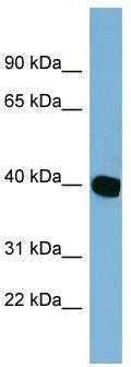WB Suggested Anti-NOXRED1 Antibody Titration: 0.2-1 ug/ml; Positive Control: HT1080 cell lysate