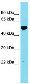 Host: Rabbit; Target Name: C14orf166B; Sample Tissue: Fetal Heart lysates; Antibody Dilution: 1.0 ug/ml.