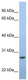 WB Suggested Anti-EMC7Antibody Titration: 0.2-1 ug/ml; ELISA Titer: 1: 312500; Positive Control: Human Muscle