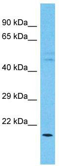 Host: Rabbit; Target Name: C15orf26; Sample Tissue: Esophagus Tumor lysates; Antibody Dilution: 1.0 ug/ml