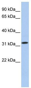 WB Suggested Anti-C15orf26 Antibody Titration: 0.2-1 ug/ml; Positive Control: 721_B cell lysate