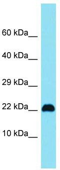 Host: Rabbit; Target Name: C15orf32; Sample Tissue: Jurkat Whole Cell lysates; Antibody Dilution: 1.0 ug/ml.