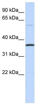 WB Suggested Anti-C16orf46 Antibody Titration: 0.2-1 ug/ml; ELISA Titer: 1: 1562500; Positive Control: Human brain