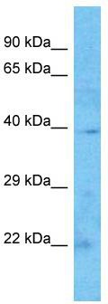 Host: Rabbit; Target Name: C16orf46; Sample Tissue: Esophagus Tumor lysates; Antibody Dilution: 1.0 ug/ml