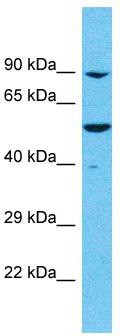 Host: Rabbit; Target Name: MEIOB; Sample Tissue: Uterus Tumor lysates; Antibody Dilution: 1.0ug/ml