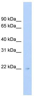 WB Suggested Anti-C16orf73 Antibody Titration: 0.2-1 ug/ml; Positive Control: Human Liver