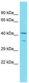 Host: Rabbit; Target Name: C16orf93; Sample Tissue: 721_B Whole Cell lysates; Antibody Dilution: 1.0 ug/ml.