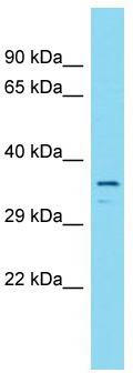 Host: Rabbit; Target Name: C16orf93; Sample Tissue: Fetal Brain lysates; Antibody Dilution: 1.0 ug/ml.