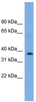WB Suggested Anti-C17orf48 Antibody Titration: 0.2-1 ug/ml; ELISA Titer: 1:312500; Positive Control: NCI-H226 cell lysateADPRM is supported by BioGPS gene expression data to be expressed in NCIH226