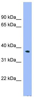 WB Suggested Anti-C17orf48 Antibody Titration: 0.2-1 ug/ml; Positive Control: HepG2 cell lysate