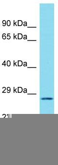 Host: Rabbit; Target Name: C17orf77; Sample Tissue: RPMI-8226 Whole Cell lysates; Antibody Dilution: 1.0 ug/ml.