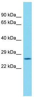 Host: Rabbit; Target Name: C19orf52; Sample Tissue: Plancenta lysates; Antibody Dilution: 1.0 ug/ml.
