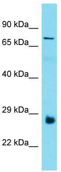 Host: Rabbit; Target Name: C19orf55; Sample Tissue: Thyroid Tumor lysates; Antibody Dilution: 1.0 ug/ml