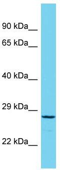Host: Rabbit; Target Name: C19orf57; Sample Tissue: RPMI-8226 Whole Cell lysates; Antibody Dilution: 1.0ug/ml
