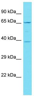 Host: Rabbit; Target Name: C19orf67; Sample Tissue: Jurkat Whole Cell lysates; Antibody Dilution: 1.0 ug/ml
