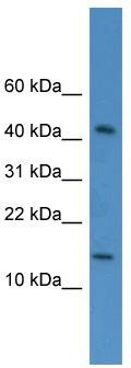 WB Suggested Anti-FLJ10490 Antibody Titration: 0.2-1 ug/ml; ELISA Titer: 1:1562500; Positive Control: HepG2 cell lysate