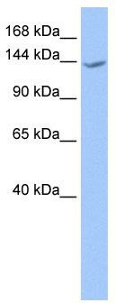 WB Suggested Anti-CACHD1 Antibody Titration: 0.2-1 ug/ml; Positive Control: Human brain
