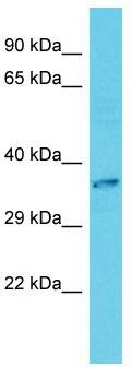 Host: Rabbit; Target Name: CAMKMT; Sample Tissue: HepG2 Whole Cell lysates; Antibody Dilution: 1.0ug/mlCAMKMT is supported by BioGPS gene expression data to be expressed in HepG2