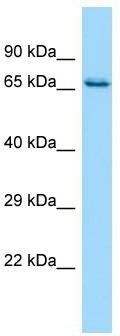 Host: Rabbit; Target Name: CARS2; Sample Tissue: HepG2 Whole Cell lysates; Antibody Dilution: 1.0ug/ml