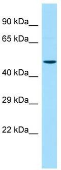 Host: Rabbit; Target Name: CBWD2; Sample Tissue: Hela Whole cell lysates; Antibody Dilution: 1.0ug/ml