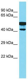 Host: Rabbit; Target Name: CBWD2; Sample Tissue: Fetal Kidney lysates; Antibody Dilution: 1.0ug/ml
