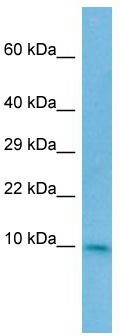 WB Suggested Anti-CC2D2A Antibody; Titration: 1.0 ug/ml; Positive Control: MDA-MB-435S Whole Cell