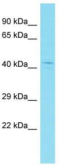 Host: Rabbit; Target Name: CCDC74B; Sample Tissue: MCF7 Whole Cell lysates; Antibody Dilution: 1.0 ug/ml.