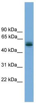 WB Suggested Anti-CCDC76 Antibody Titration: 0.2-1 ug/ml; Positive Control: Human Lung