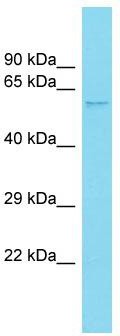 Host: Rabbit; Target Name: Ccdc85a; Sample Tissue: Rat Lung lysates; Antibody Dilution: 1.0ug/ml