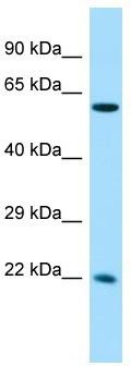 Host: Rabbit; Target Name: CCDC85A; Sample Tissue: Fetal Liver lysates; Antibody Dilution: 1.0ug/ml