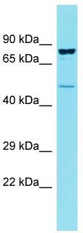Host: Rabbit; Target Name: CCDC121; Sample Tissue: OVCAR-3 Whole Cell lysates; Antibody Dilution: 1.0ug/mlCCDC121 is supported by BioGPS gene expression data to be expressed in OVCAR3