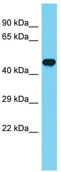 Host: Rabbit; Target Name: CCDC121; Sample Tissue: Fetal Brain lysates; Antibody Dilution: 1.0ug/ml