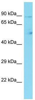 Host: Rabbit; Target Name: CCDC142; Sample Tissue: Hela Whole cell lysates; Antibody Dilution: 1.0 ug/ml.