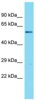 Host: Rabbit; Target Name: CCDC176; Sample Tissue: PANC1 Whole Cell lysates; Antibody Dilution: 1.0ug/ml